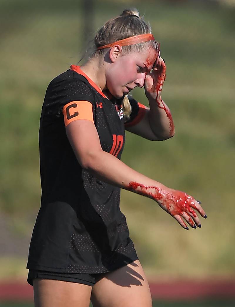 Libertyville’s Pru Babat walks bloodied off the field after colliding with teammate Maddy Kopala in the IHSA girls state soccer semifinal game against Barrington at North Central College in Naperville on Friday, June 2, 2023.