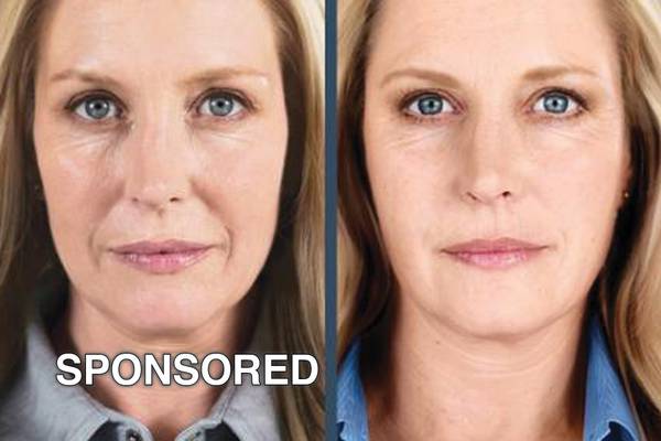 Rejuvenate for Fall: Save on Restylane Dermal Fillers and Obagi Products This September