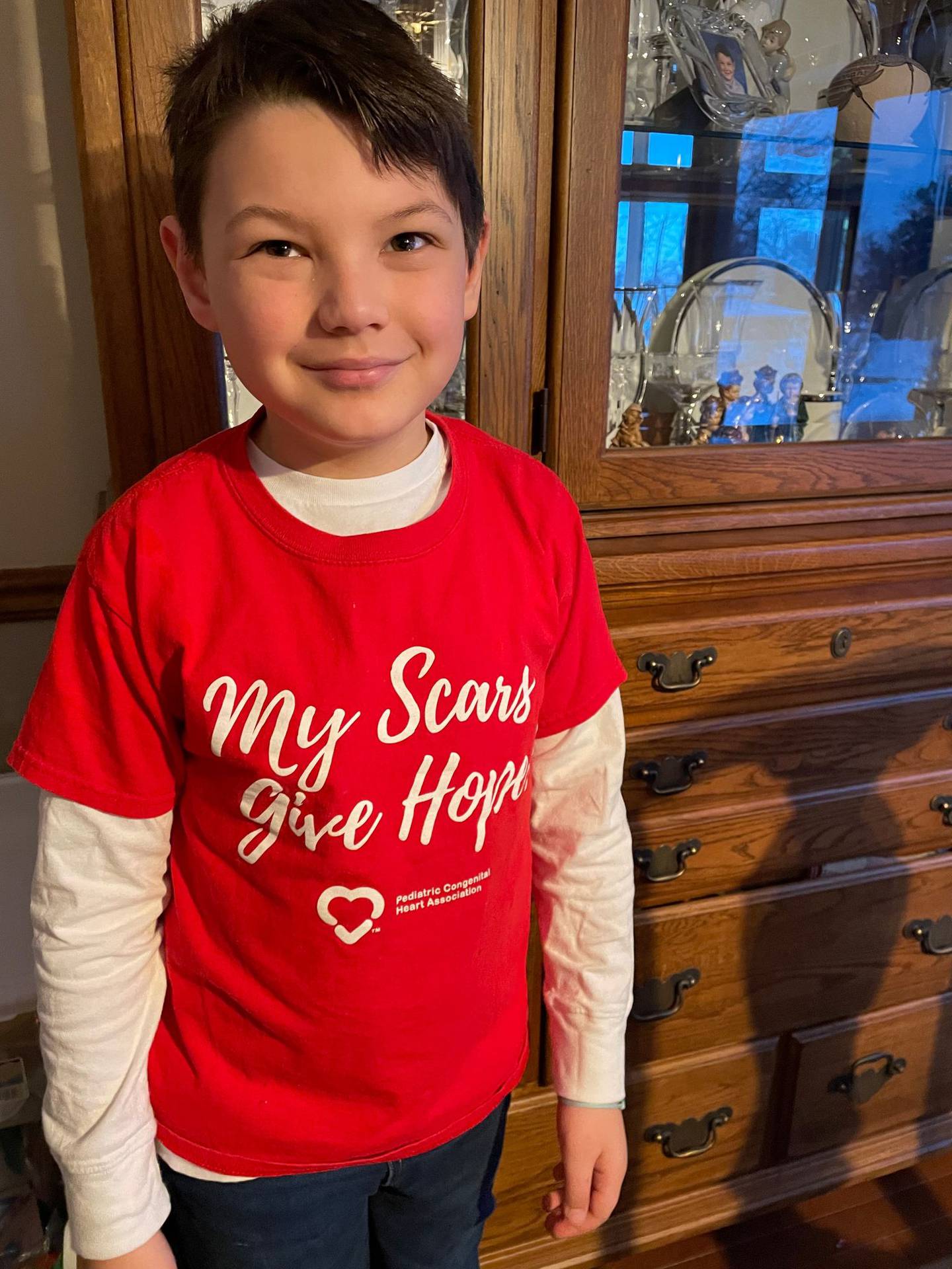 David Skelley, 7, of Homer Glen, had surgery to reconstruct his right pulmonary artery when he was 5 months old. He was previously diagnosed as failure to thrive. His parents Dave and Jenna Skelley had no idea David had a congenital heart disease until 36 hours before David's surgery.