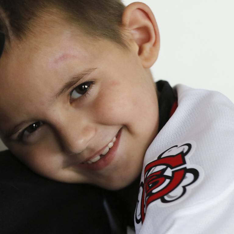 Alex Moscrip, 7, son of Brad and Aleksandra, on Wednesday. Nov 13, 2024 at his home in McHenry Township. Hewas hit by a car in July and left with traumatic brain injury and is now recovering at home.