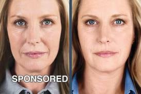 Rejuvenate for Fall: Save on Restylane Dermal Fillers and Obagi Products This September