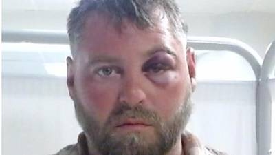 Reckless driver wreaks havoc, injuring several people during police pursuit through Lake County: authorities