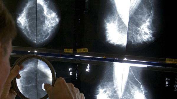 October is Breast Cancer Awareness Month. Remember to get mammogram: OSF St. Katharine