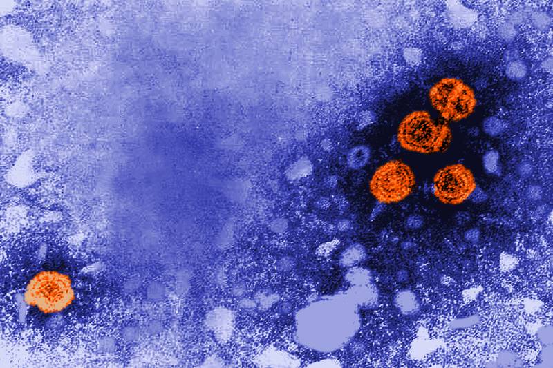 This 1981 electron microscope image made available by the U.S. Centers for Disease Control and Prevention shows hepatitis B virus particles, indicated in orange. The round virions, which measure 42nm in diameter, are known as Dane particles. (Dr. Erskine Palmer/CDC via AP)