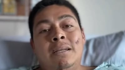 2 members of Mexican band whose van crashed in McHenry remain in the hospital; fundraising underway