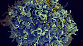 UN says if US funding for HIV programs is not replaced, millions more will die by 2029