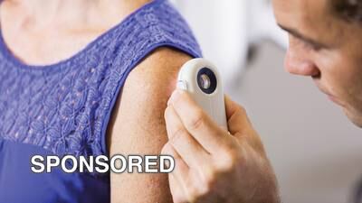 Morrison Community Hospital Offers Free Skin Cancer Screenings