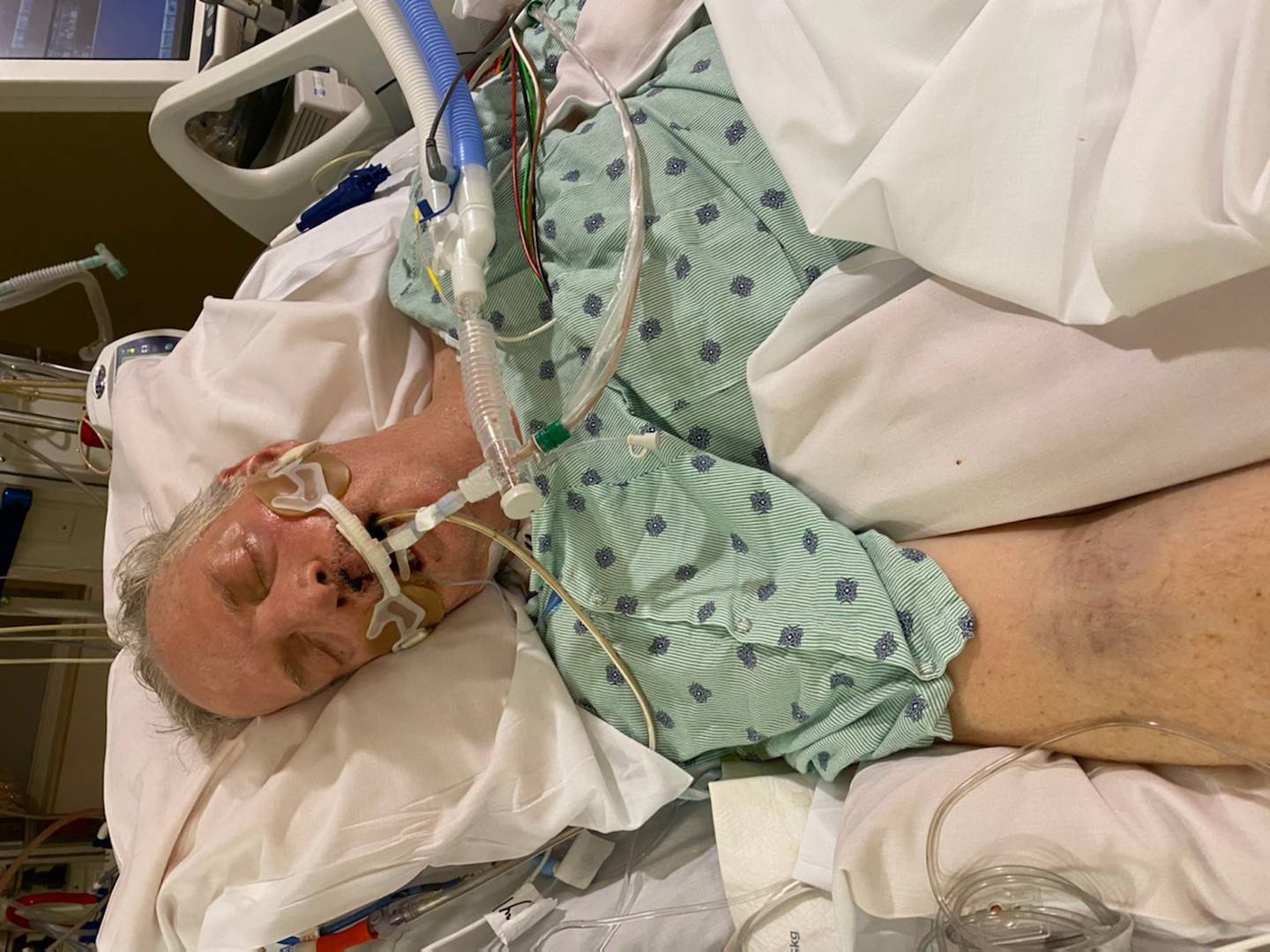 Downers Grove native Rich Kulovany, now of Scottsbluff, Nebraska, in induced coma from COVID-19 contracted in December 2020.
