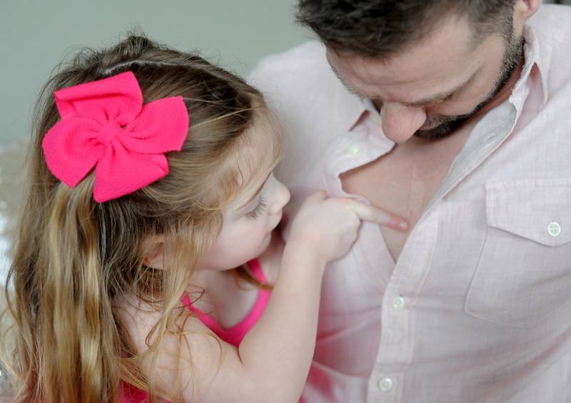 Everly Backe, 4, who has had multiple open heart surgeries to correct congenital heart defects, looks at her dad’s new tattoo Friday, Feb. 11, 2022. As Everly has became more aware of her chest scar, which they call her "zipper," her dad, Matt Backe, recently decided to get a tattoo that matches his daughter's scar from her surgeries so she does not feel alone in having the scar.