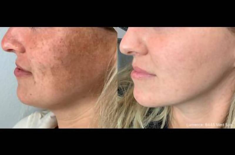 Eterna MedSpa & Laser Vein Center - Unlock Your Best Skin With Eterna MedSpa’s April Beauty Deals