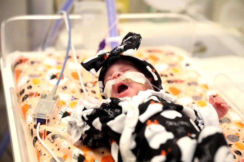 Joanna Mays yawns during Halloween in the neonatal intensive care unit of Northwestern Central DuPage Hospital in Winfield on Tuesday, Oct. 31, 2023.