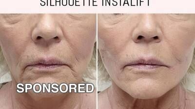 What is the Silhouette InstaLift?