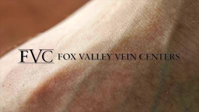 [Sponsored] Fox Valley Vein Centers - Sandwich, Yorkville, Plainfield & Aurora