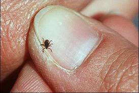 Kane County Health Department offers tick removal kits