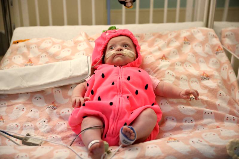 Valerie Wesser shows off her strawberry costume during Halloween in the neonatal intensive care unit of Northwestern Central DuPage Hospital in Winfield on Tuesday, Oct. 31, 2023.