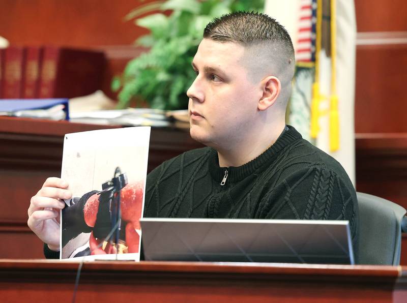 James Corralejo, of DeKalb, holds up a photo of what he said is a rash on his leg caused by an ankle monitor as he testifies in Judge Philip Montgomery’s courtroom Monday, April 29, 2024, during a hearing on his case at the DeKalb County Courthouse in Sycamore. Corralejo is charged with reckless homicide and DUI causing death in the fatal crash Nov. 5, 2023, that killed DeKalb woman Graciela Reza Contreras, 59. Prosecutors alleged his ankle monitor showed signs of tampering.