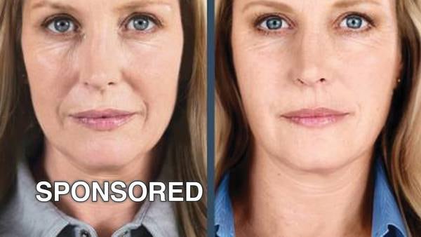 Rejuvenate for Fall: Save on Restylane Dermal Fillers and Obagi Products This September