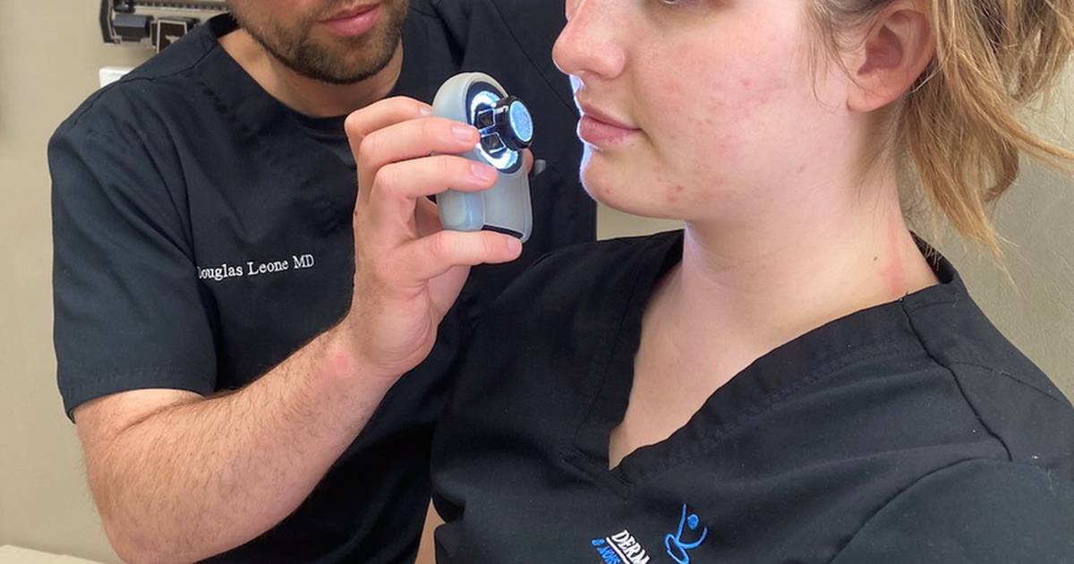 Redfaced Masks are causing rosacea, aggravating teen acne Shaw Local