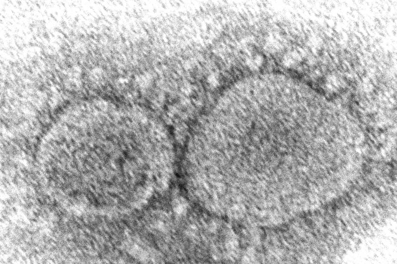 FILE - This 2020 electron microscope image made available by the Centers for Disease Control and Prevention shows SARS-CoV-2 virus particles, which cause COVID-19. The House voted unanimously Friday, March 10, 2023, to declassify U.S. intelligence information about the origins of COVID-19, a sweeping show of bipartisan support near the third anniversary of the start of the deadly pandemic. (Hannah A. Bullock, Azaibi Tamin/CDC via AP, File)