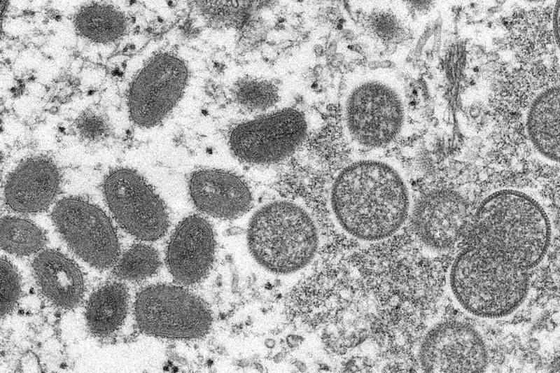 Mature, oval-shaped monkeypox virions, left, and spherical immature virions are seen in an electron microscope. (CDC via AP, File)