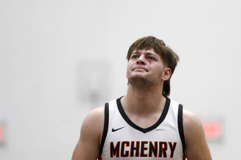 McHenry's Conner McLean looks up at at the score board as he walks off the court after getting injured during a Fox Valley Conference boys basketball game against Crystal Lake South on Wednesday, Dec. 11, 2024, at McHenry High School.