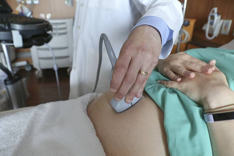 FILE - A doctor performs an ultrasound scan on a pregnant woman at a hospital in Chicago, Aug. 7, 2018. (AP Photo/Teresa Crawford, File)