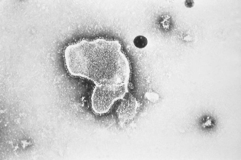 This 1981 photo provided by the Centers for Disease Control and Prevention (CDC) shows an electron micrograph of Respiratory Syncytial Virus, also known as RSV.