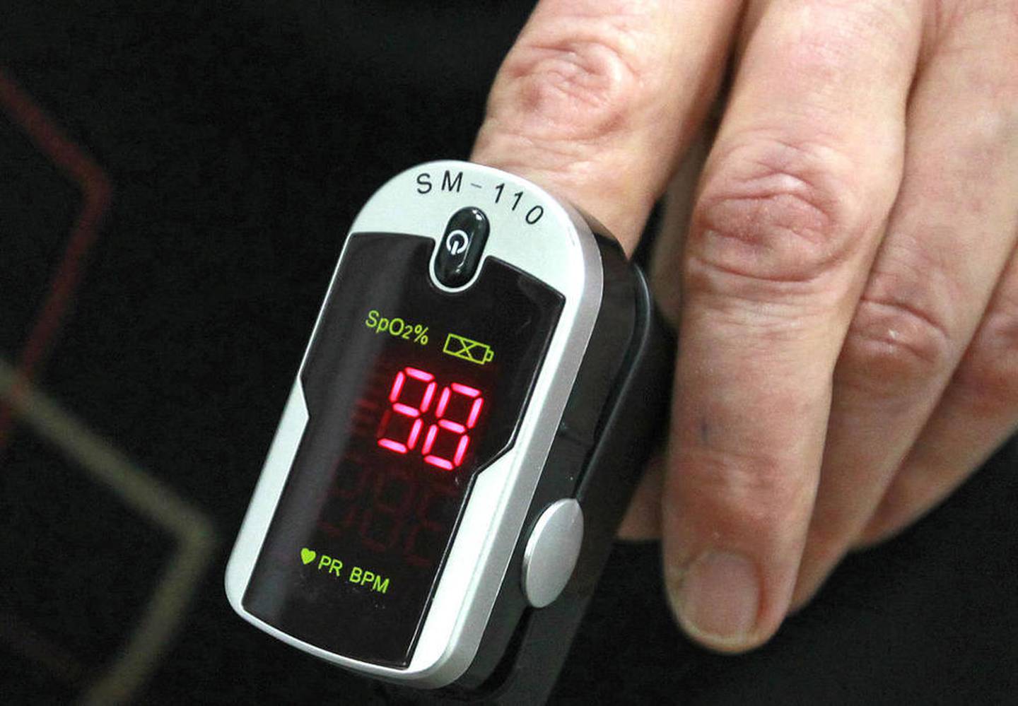 Dr. David Potts demonstrates how a pulse oximeter is used on patients during oral conscience sedation to measure their blood pressure, blood oxygen and pulse during dental procedures at Lake County Dental Care in Libertyville.