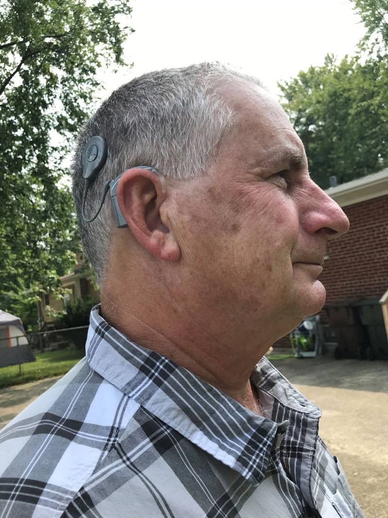 Silver Cross Hospital - Hearing Improves Dramatically for Richton Park Man Following Cochlear Implant Surgery at Silver Cross