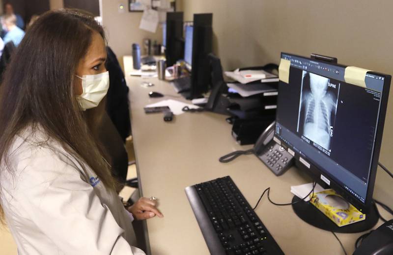 Dr. Sara Qazi looks at a Child's chest x-ray Tuesday, Sept. 27, 2022, at Northwest Medicine Huntley Hospital.  Area hospital are seeing an increase in children with upper respiratory illnesses.