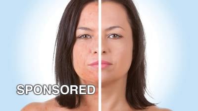 Rejuvenate Your Skin This Fall With Microneedling at Eterna MedSpa