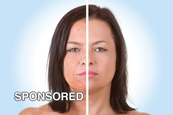 Rejuvenate Your Skin This Fall With Microneedling at Eterna MedSpa