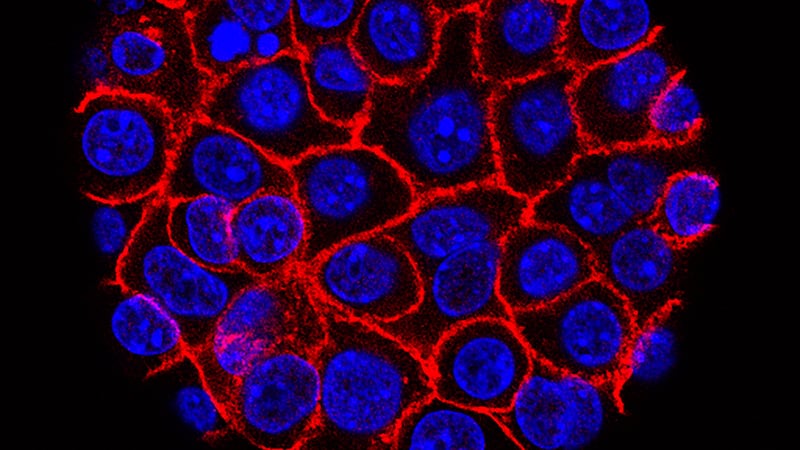 Experimental pill promises new hope for deadly pancreatic cancer