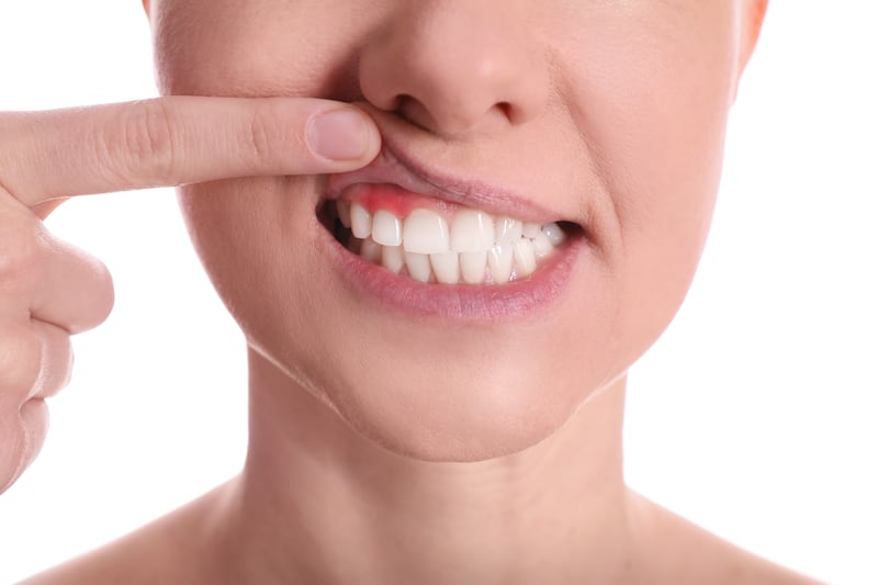 Manus Dental Yorkville- Bleeding Gums Aren’t Normal: What Can They Mean?