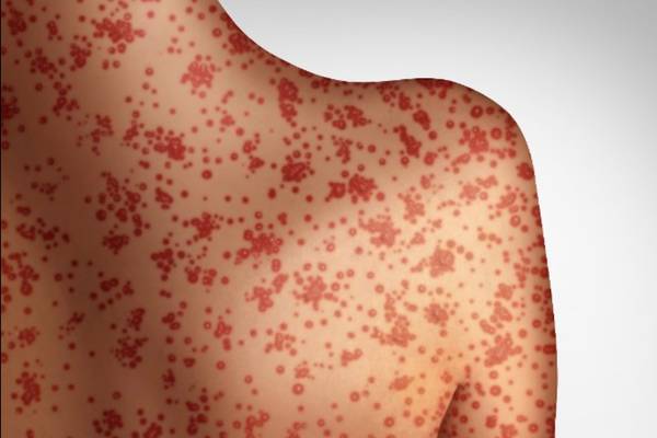 Kane Health Dept. to host Communicable Disease Conference
