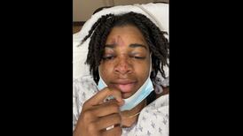 Quincy police investigate alleged ‘racist attack’ against Joliet West alum Jazzpher Evans at club